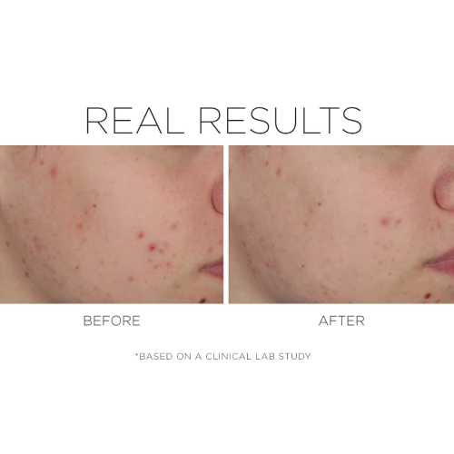 Cosmedix Shineless Oil-Free Moisturiser