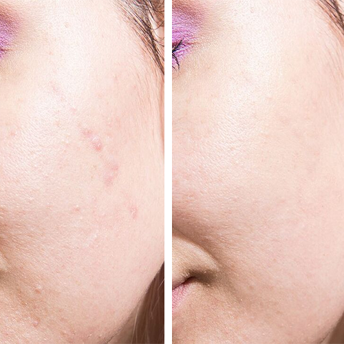 Kryolan Dermacolor Concealer Sticks