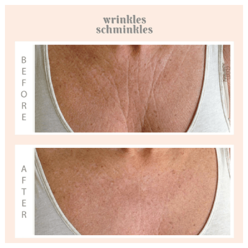 Wrinkles Schminkles Chest Wrinkle Pads Adore Beauty