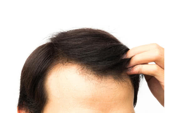 existuje rozdíl mezi doplňky vlasů pro muže a ženy?'s and women's hair supplements?