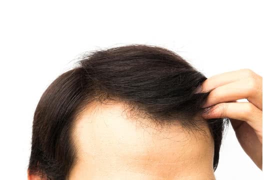 ¿Hay una diferencia entre los suplementos para el cabello para hombres y mujeres?'s and women's hair supplements?