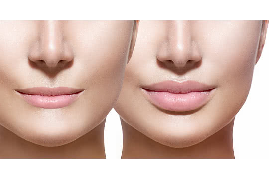 For lip after before and tutorials thin lips surgery makeup smith blazers