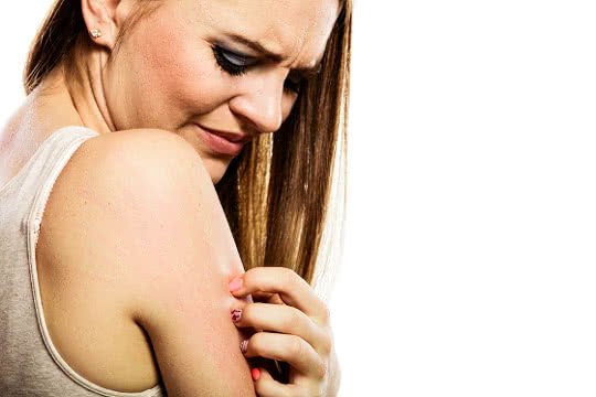 How Do I Know What Type of Eczema I Have?