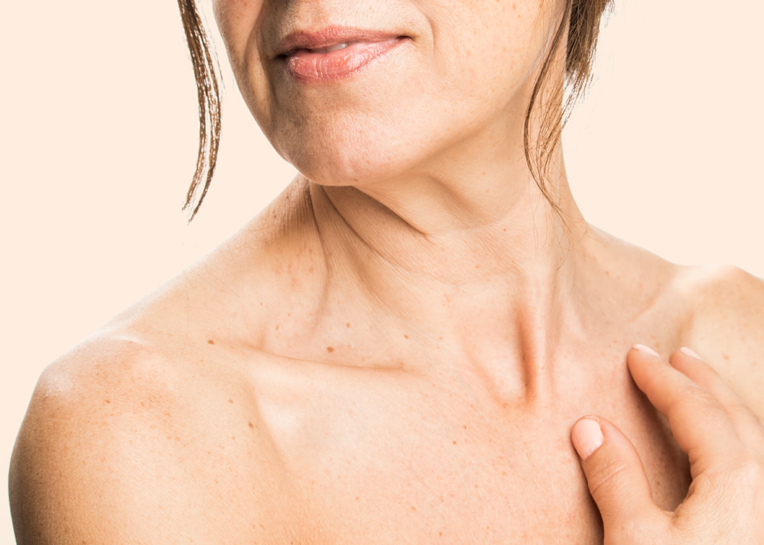 How Do I Get Rid Of Lines On My Neck?