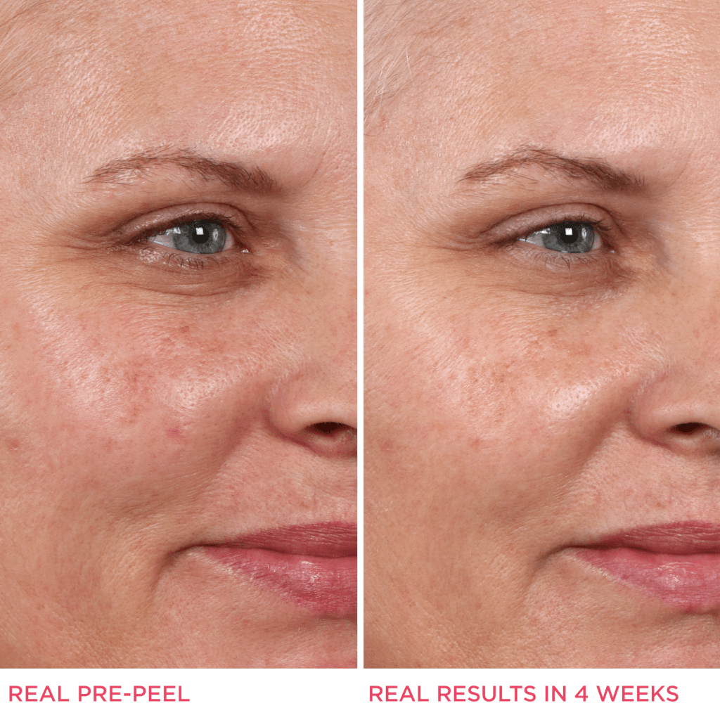 Shop 20 off IT Cosmetics Hello Results Glycolic Oil and Peel T&Cs