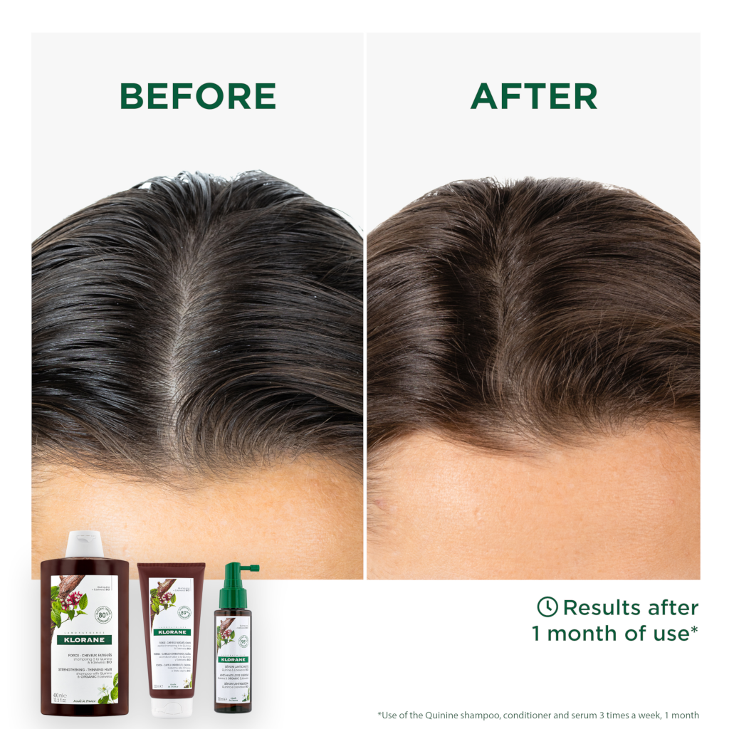 Klorane shop shampoo review