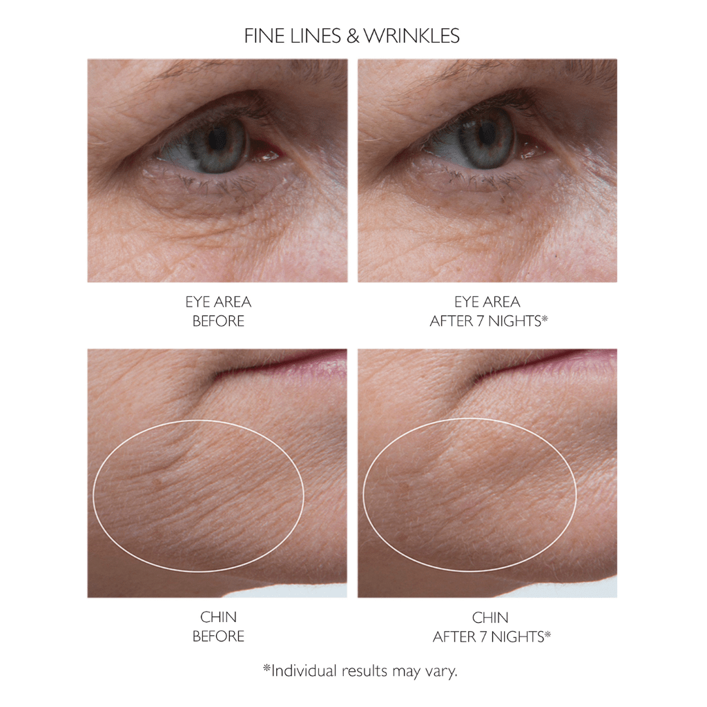 Peter Thomas Roth AntiAge Ptr Retinol Fusion PM 30ml AU Adore Beauty