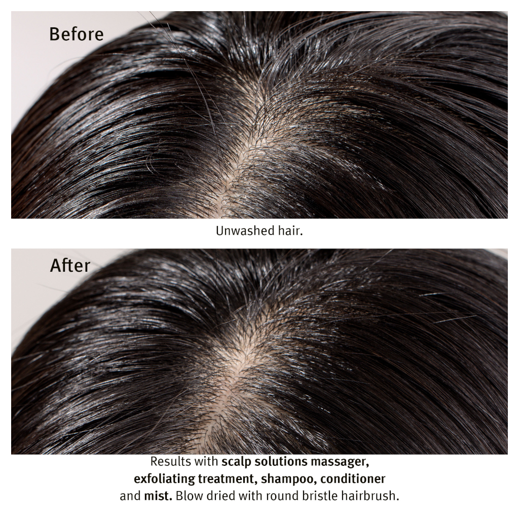 AVEDA Scalp Solutions Stimulating Scalp Massager