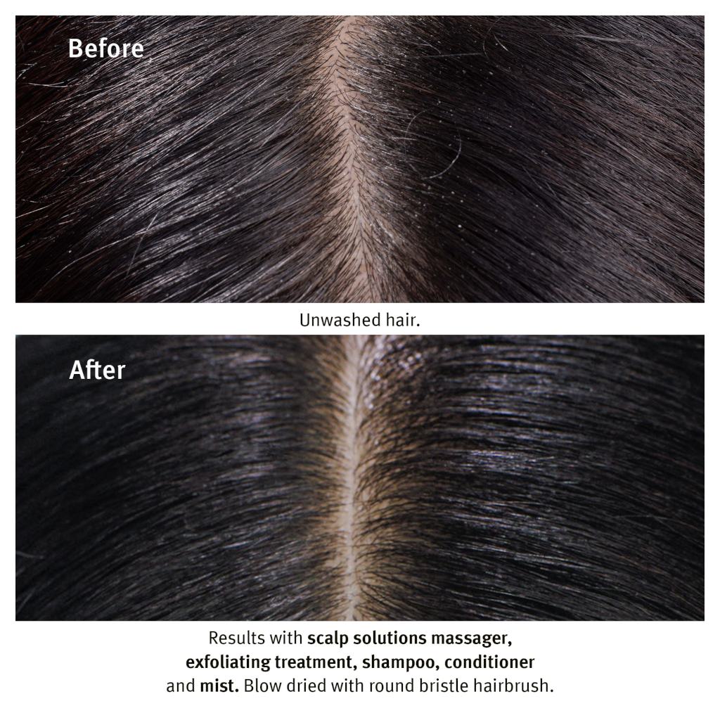 AVEDA Scalp Solutions Stimulating Scalp Massager
