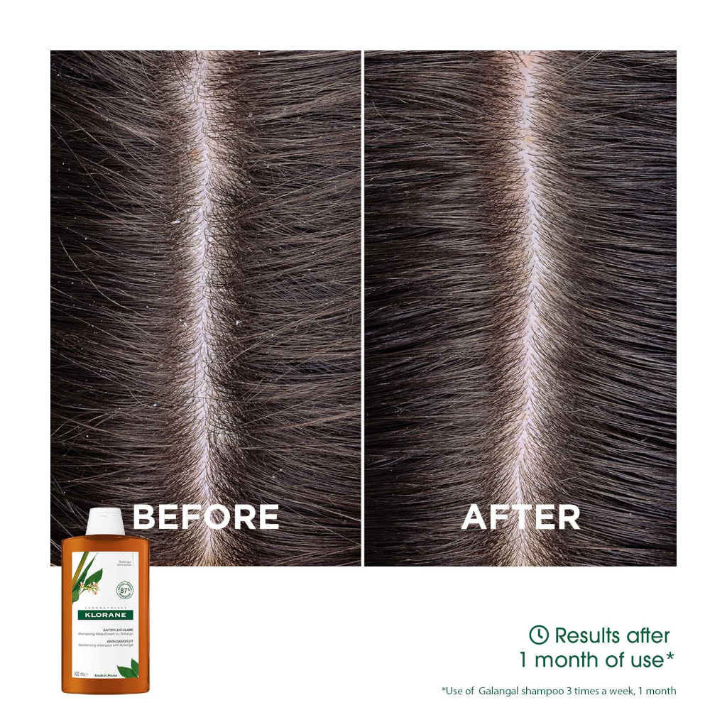 Klorane Anti-dandruff Rebalancing Shampoo with Galangal & AHA 400ML