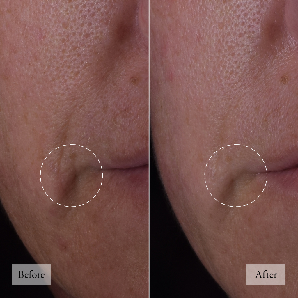 philosophy dose of wisdom skin serum