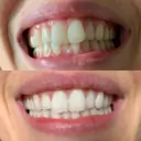 Gem Whitening Pen