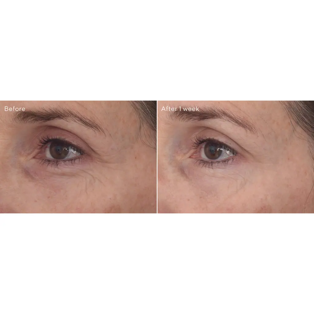 Murad Retinal ReSculpt Eye Treatment