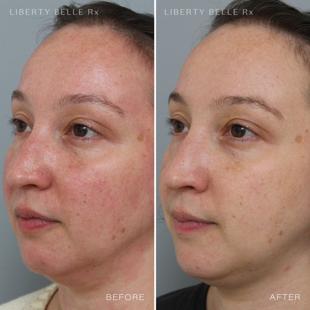 Liberty Belle Rx by Dr Moss POWER BROKER® Anti-Red Wrinkle Defence Cream with Squalane - 50ml