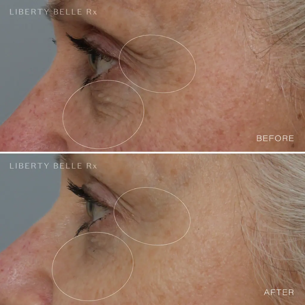 Liberty Belle Rx by Dr Moss EYE DREAM® Restorative Retinol 0.625 Eye Cream - 15ml
