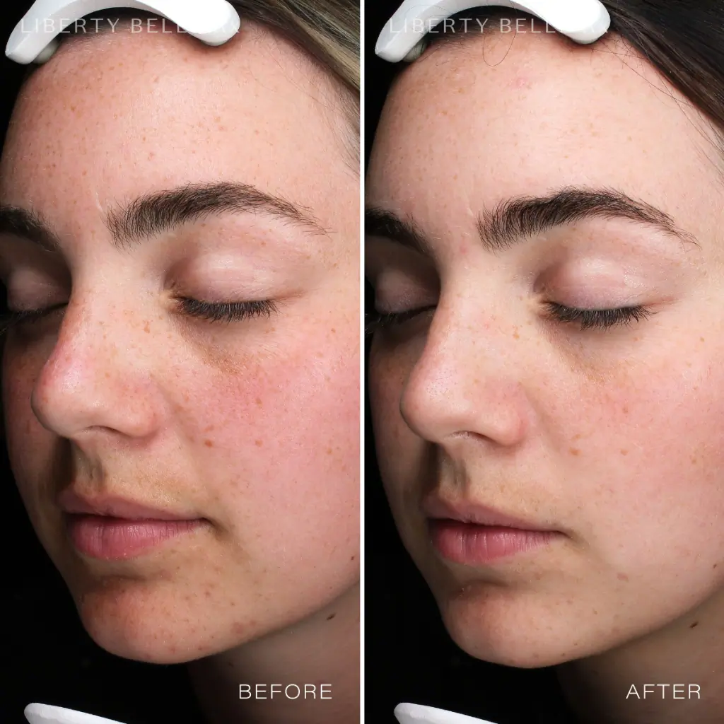 Liberty Belle Rx by Dr Moss GODSEND® Luxe Radiance Face Oil with 10 Plant-Derived Super Oils - 30ml