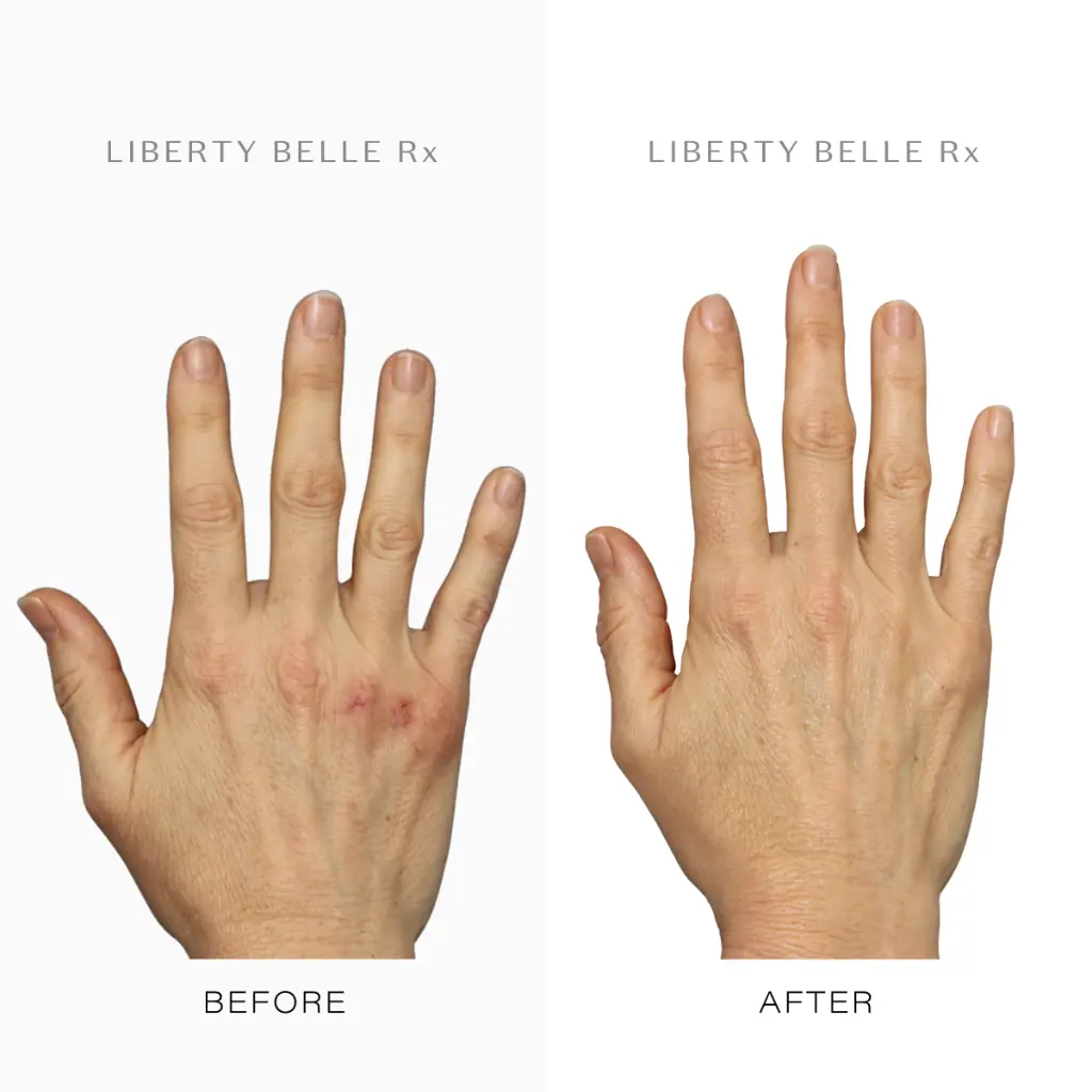 Liberty Belle Rx by Dr Moss BELLE™ Intensive Rejuvenating Hand Cream - 100ml