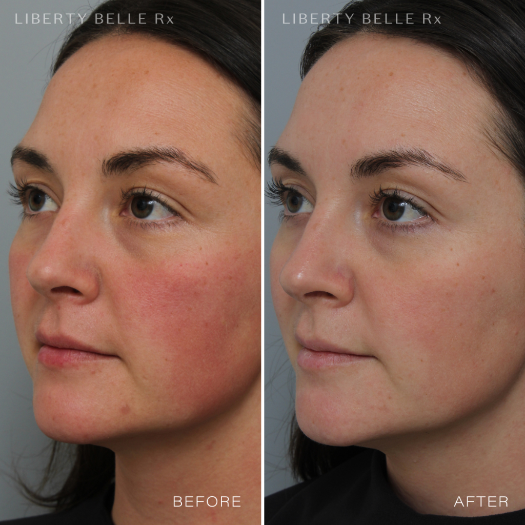 Liberty Belle Rx by Dr Moss GAME CHANGER® Pore Refining & Mattifying Gel With Vitamin C - 30ml