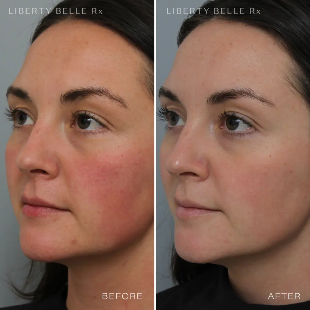 Liberty Belle Rx by Dr Moss GAME CHANGER® Pore Refining & Mattifying Gel With Vitamin C - 30ml