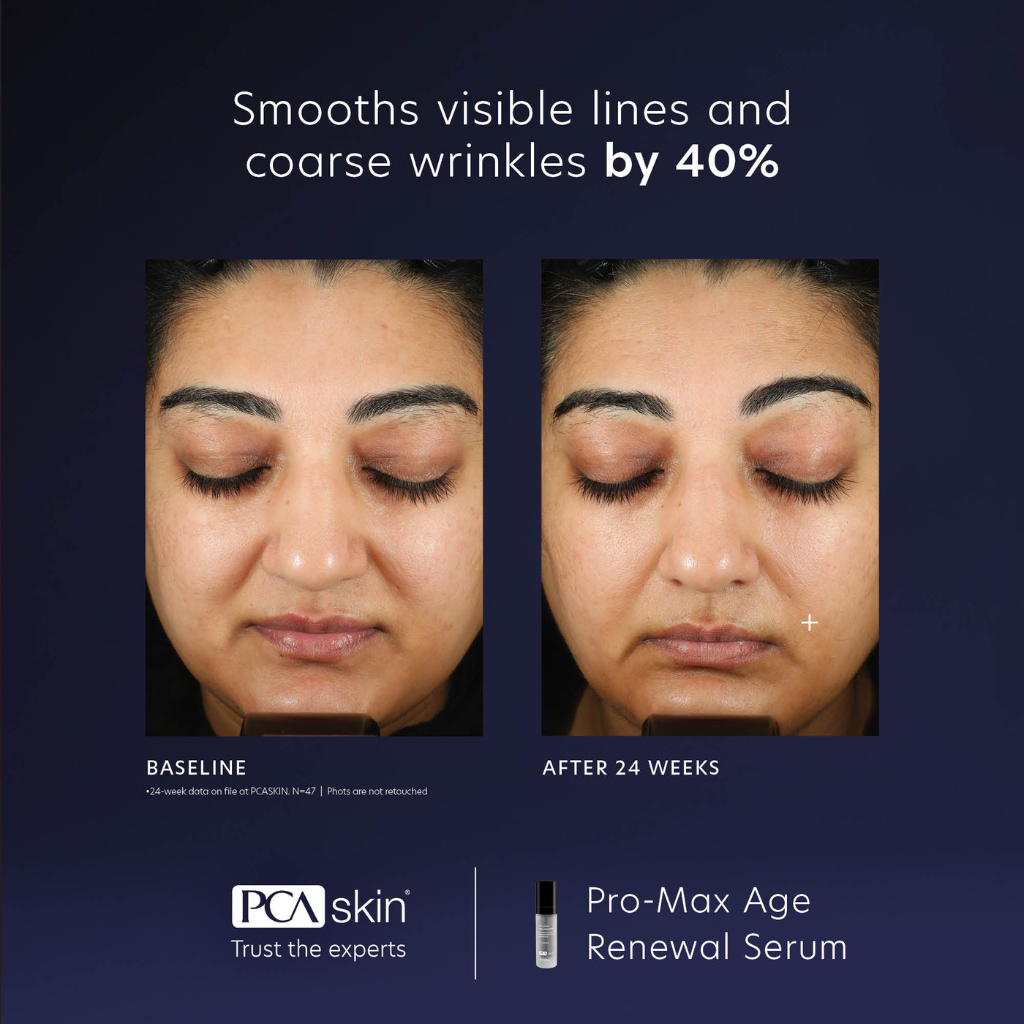 PCA Skin Pro-Max Age Renewal