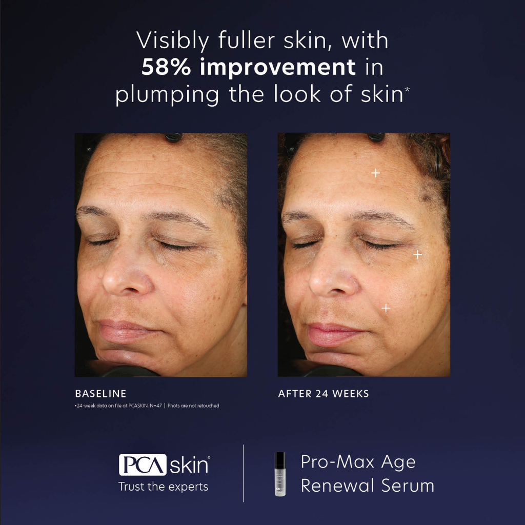 PCA Skin Pro-Max Age Renewal