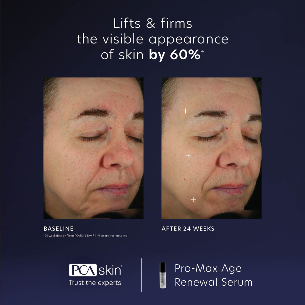 PCA Skin Pro-Max Age Renewal
