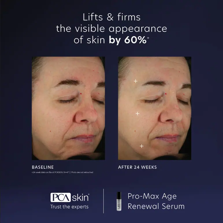 PCA Skin Pro-Max Age Renewal