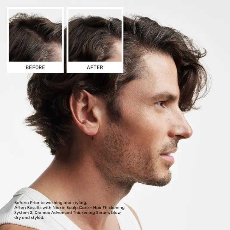 Nioxin Scalp + Hair Thickening System 2 - Natural Hair with Progressed Thinning