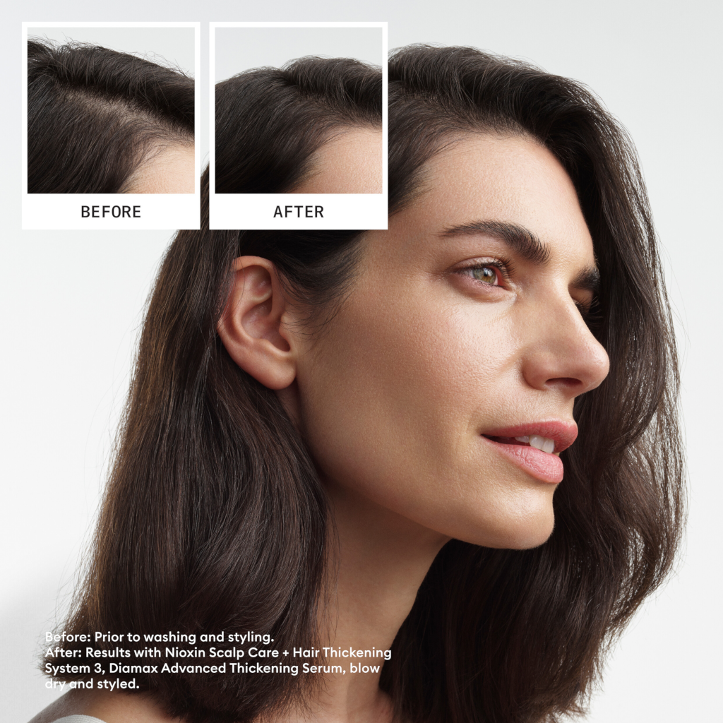 Nioxin Scalp + Hair Thickening System 3 - Colored Or Dry Damaged Hair with Light Thinning