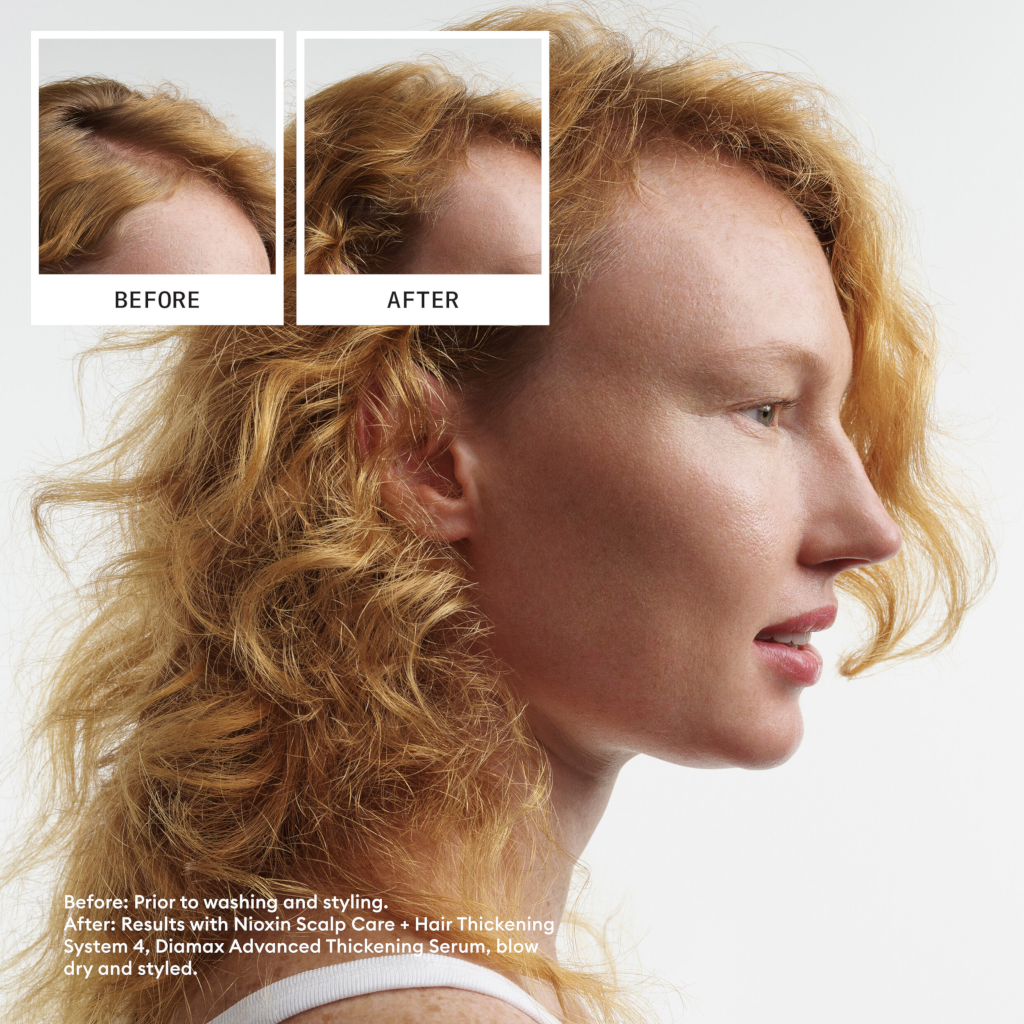 Nioxin Scalp + Hair Thickening System 4 - Colored Or Dry Damaged Hair with Progressed Thinning