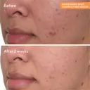Murad Rapid Dark Spot Correcting Serum 5ml