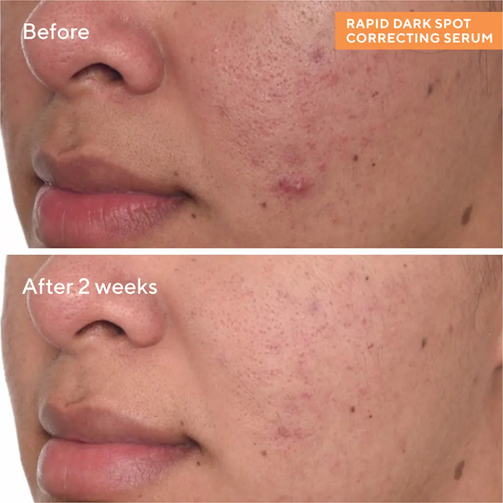 Murad Rapid Dark Spot Correcting Serum 5ml