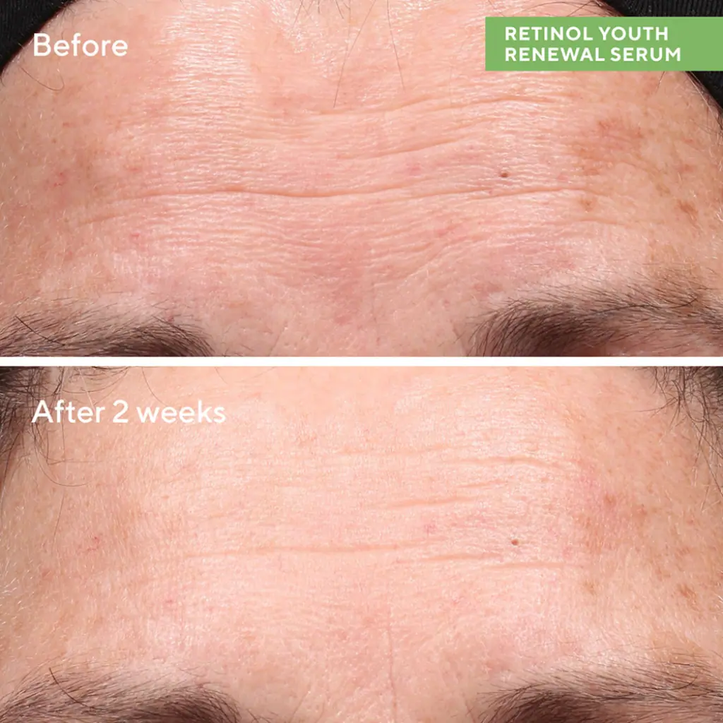 Murad Retinol Youth Renewal Serum 5ml