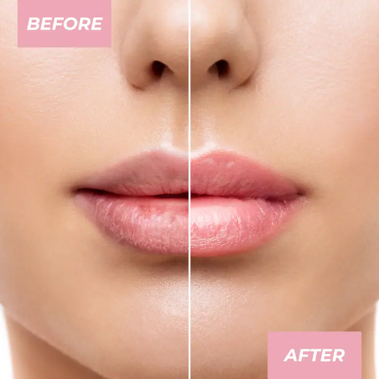 MCoBeauty Glow Up pH Lip Balm