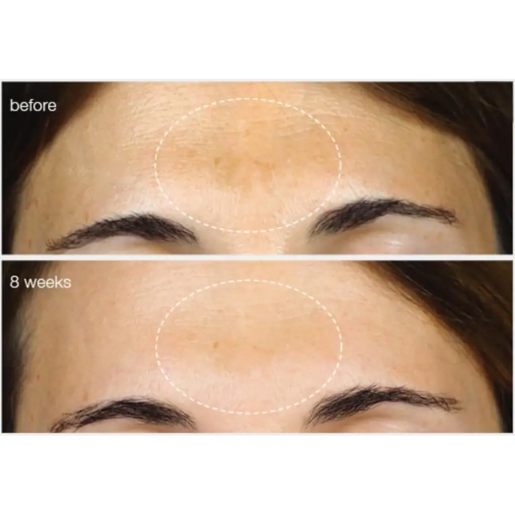 Dermalogica PowerBright Dark Spot Serum