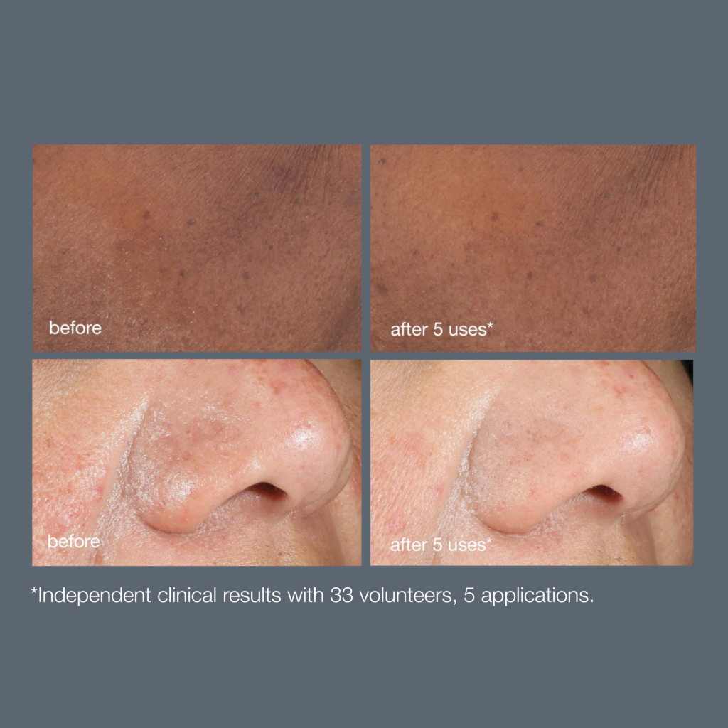 Dermalogica Powerbright Dark Spot Peel