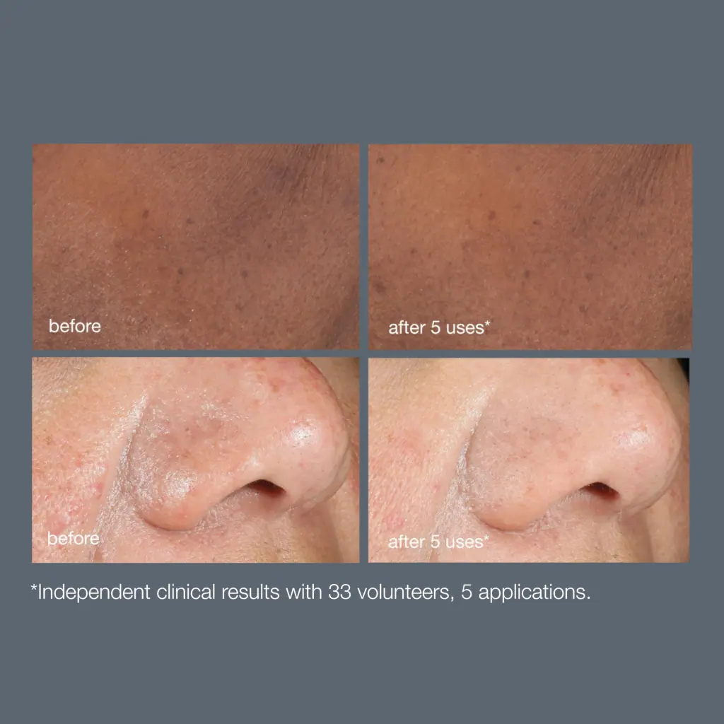 Dermalogica Powerbright Dark Spot Peel