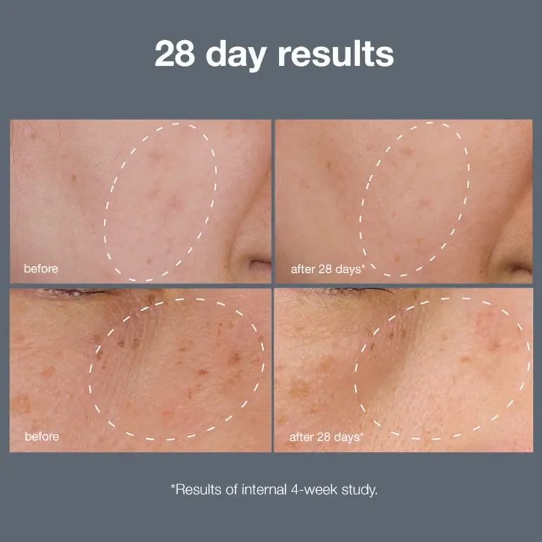 Dermalogica Powerbright Dark Spot System