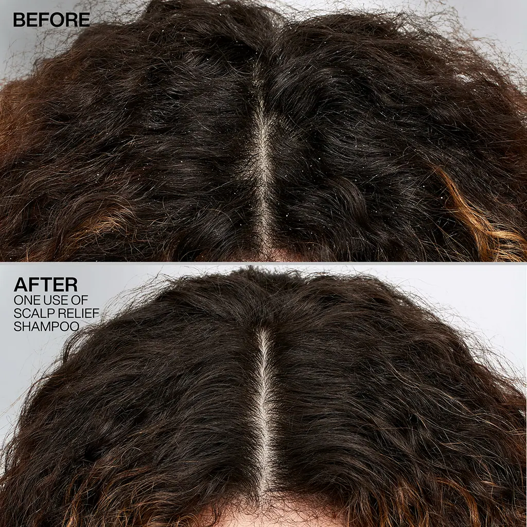 Redken Dandruff Control Shampoo