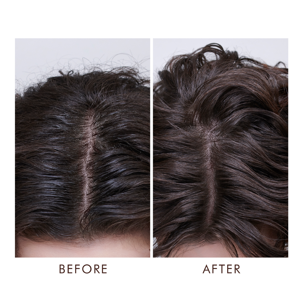 MOROCCANOIL Oily Scalp Treatment