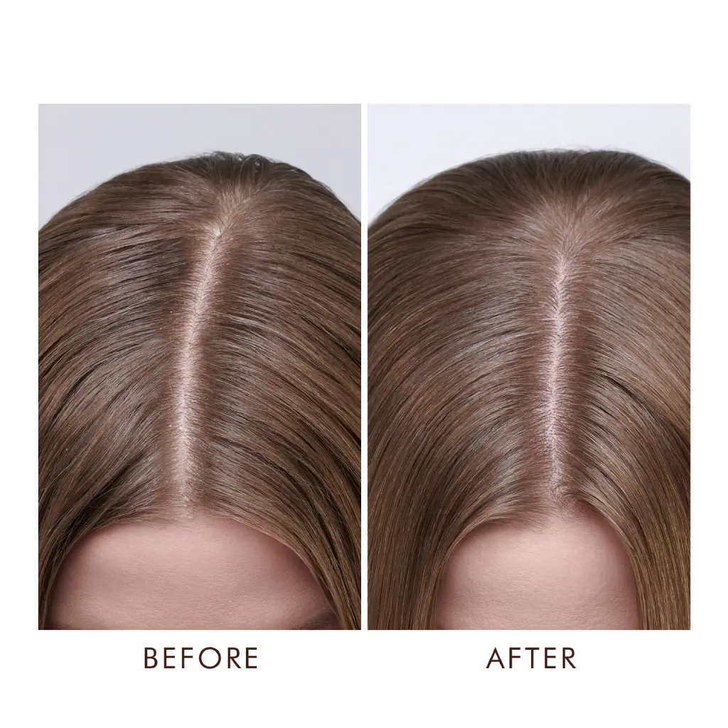 MOROCCANOIL Dry Scalp Treatment