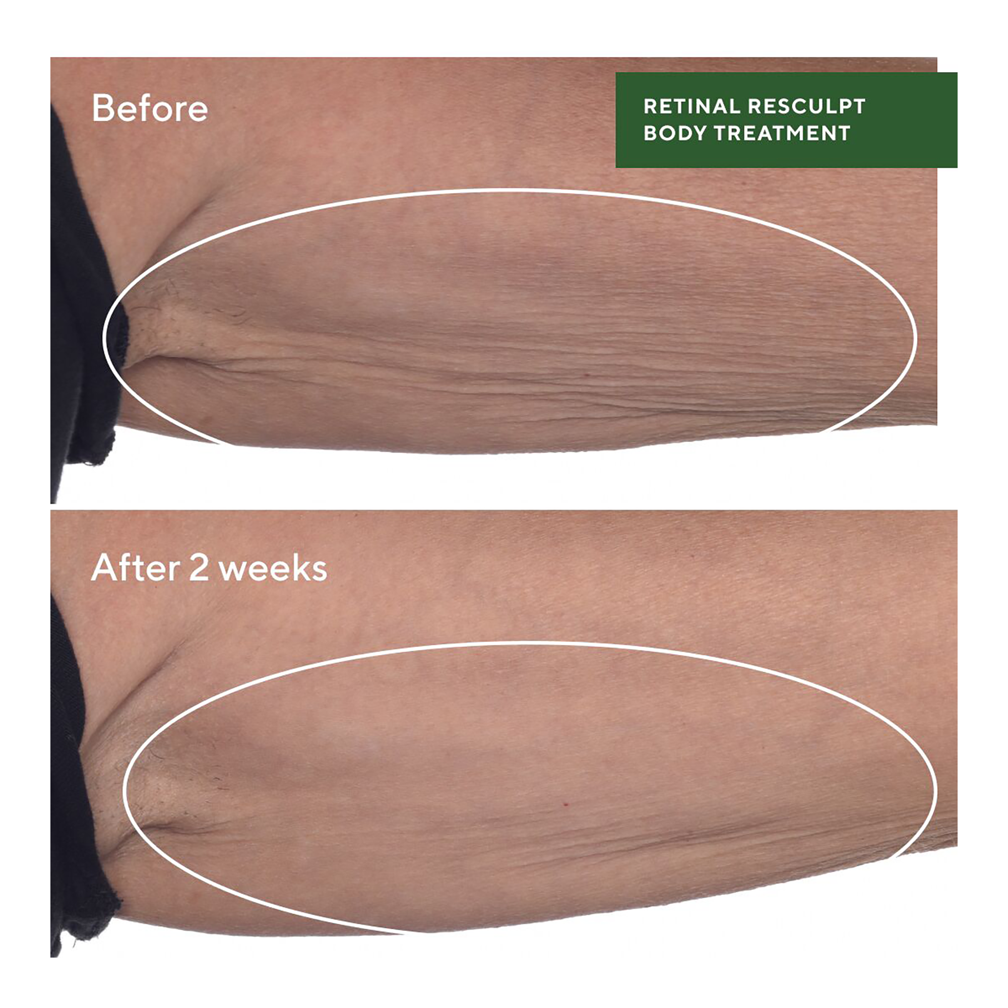 Murad Retinal ReSculpt Body Treatment