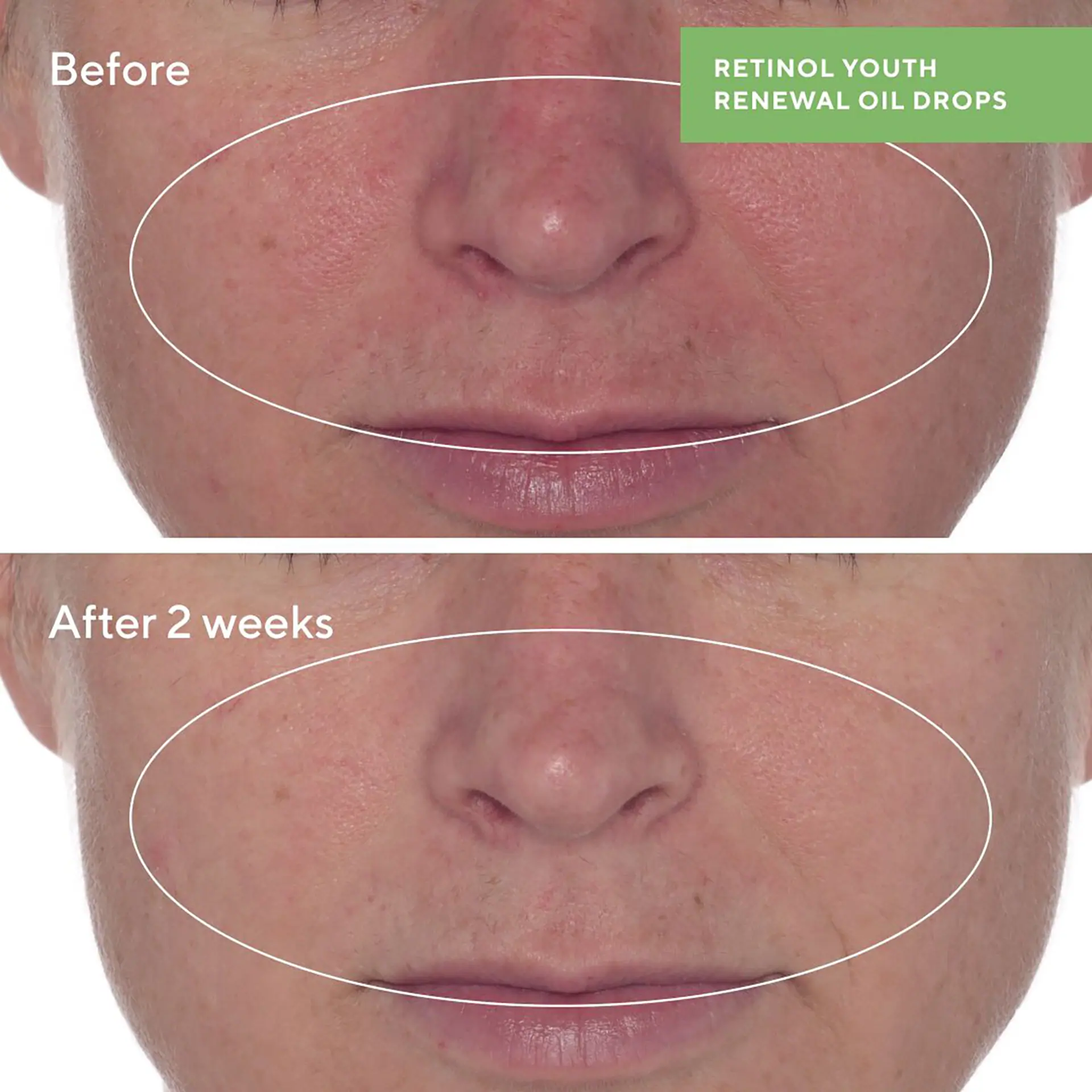 Murad Retinol Youth Renewal Oil Drops
