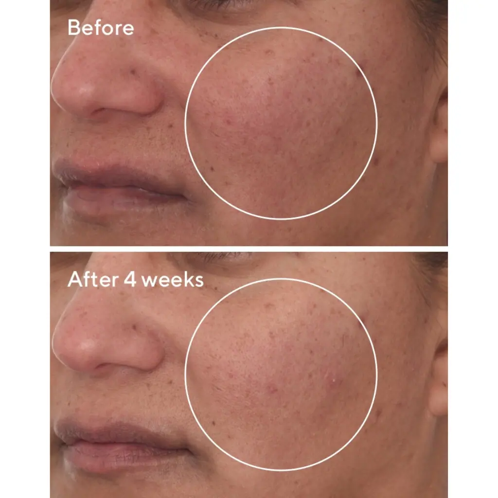 Murad Cellular Hydration Repair Serum 30ml