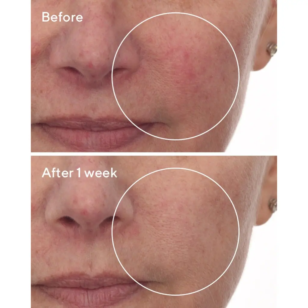 Murad Cellular Hydration Repair Serum 30ml