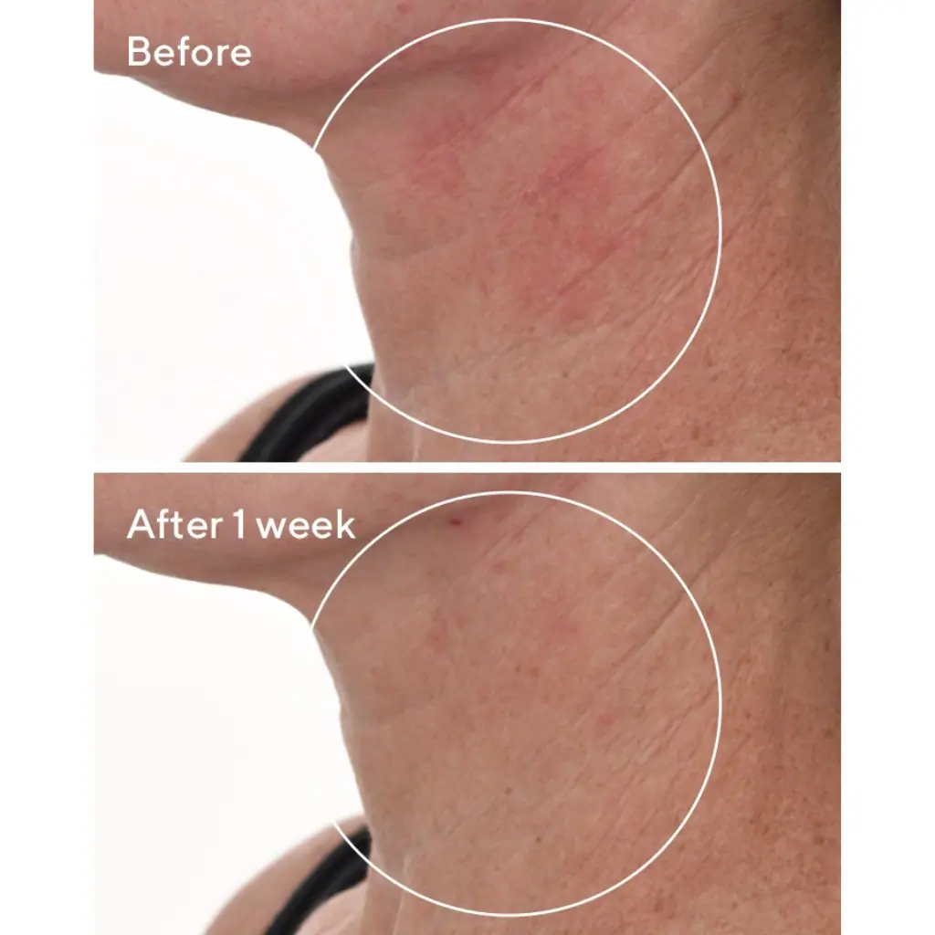 Murad Cellular Hydration Repair Serum 30ml