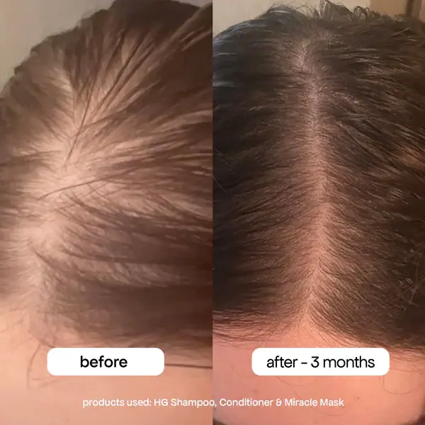 Bondi Boost Hair Growth Conditoner - 300ml