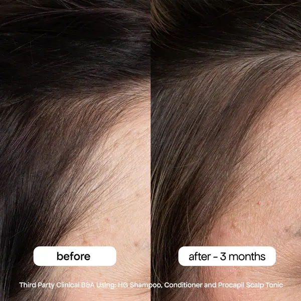 Bondi Boost Hair Growth Conditoner - 300ml