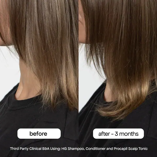 Bondi Boost Hair Growth Conditoner - 300ml