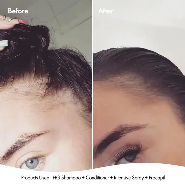 Bondi Boost Hair Growth Bundle